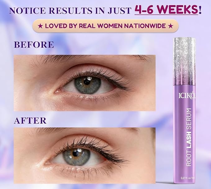 Eyelash Growth Serum - Advanced Peptide & Vitamin Formula, 96% Visible Improvement in 4 Weeks - For Longer, Thicker, Fuller Looking Lashes, Vegan & Cruelty-Free for Sensitive Eyes, 8mL