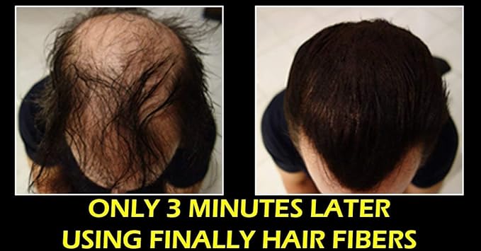 Finally Hair Fiber Lock Strong Holding Spray. Compatible/Replacement For Toppik, Xfusion, Febron, Bosley, Nanogen