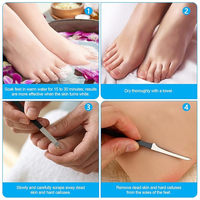 6PCS Ingrown Toenail Removal Kit, Stainless Steel Callus Dead Skin Removers, Pedicure Tools Set with a Storage Box, Professional Toenail Treatment for Feet, Foot Care Supplies at Home - Black