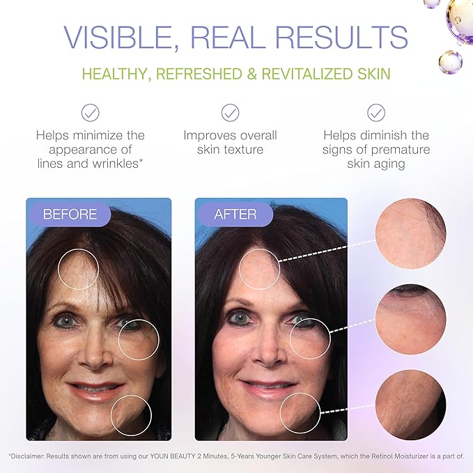 YOUN Beauty Retinol Night Cream Moisturizer for Face by Holistic Dr. Anthony Youn – Paraben-Free Face Moisturizer with Vitamin B5 & E, Hyaluronic Acid, and Green Tea for Skin Renewal, 50ml