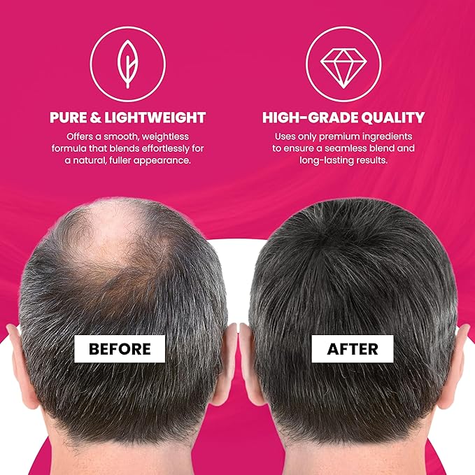 VELO Hairline Powder–GRAY Hair Root Touch Up Powder for Women & Men–Instantly Covers Gray Hair, Thinning Hair & Bald Spots–Sweatproof Root Cover Up–Puff & Mirror Compact, 13 Shades