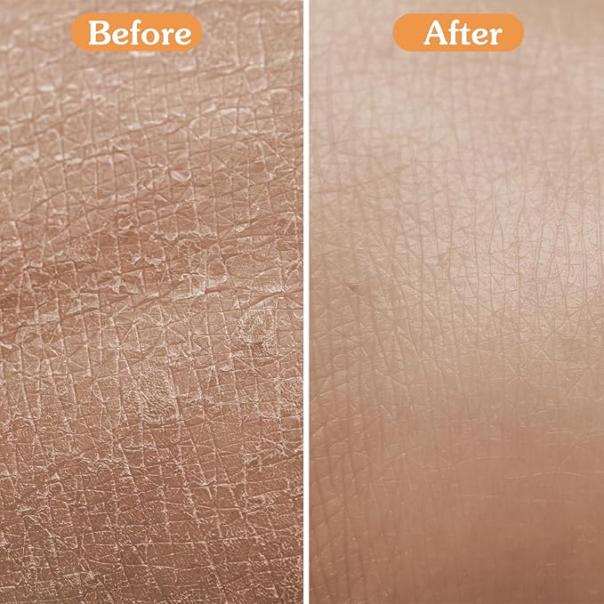 10 Pcs Dry Brushing Body Brush, Natural Bristle Body Brush with Massage Nodes for Lymphatic Drainage and Improving Skin Health and Reduces Acne, Soft Handle with Boar, Brushes for Shower