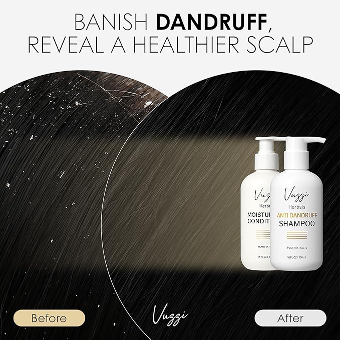 Moisturizing Conditioner for Flake-Free, Healthy Scalp & Hair Growth - Sulfate-Free, Paraben-Free & Natural Conditioner for All Hair Types