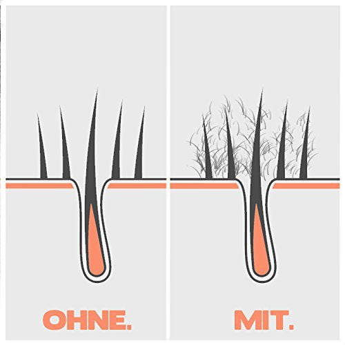 IMPERIO Hair Building Fibers for Thinning Hair - 26g Premium Hair Fibers for Women & Men in Hairdresser Quality - Hair thickening in less than 20 seconds (Medium Brown)