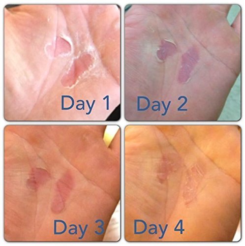 RipFix Hand Repair Balm for Dry Cracked Hands, Hand Salve for Gymnastics and Rock Climbers, Rip Fix Climbing Salve for Men and Women, Premium Gymnast Balm for Hardworking Hands, 3 Classic 1.34 oz Tins