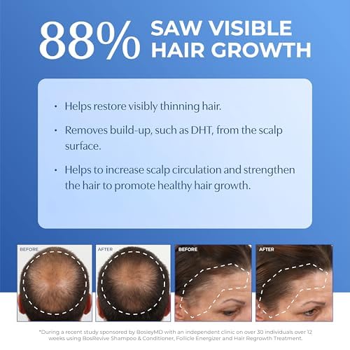BosRevive Nourishing Shampoo for Noticeably Thinning, Non Color-Treated Hair – Helps Restore Thinning Hair & Remove DHT, Product & Pollution Build-Up, Boosts Scalp Circulation, Sulfate-Free 10.1 Fl Oz