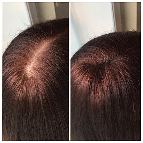 IMPERIO Hair Building Fibers for Thinning Hair - 26g Premium Hair Fibers for Women & Men in Hairdresser Quality - Hair thickening in less than 20 seconds (Medium Brown)