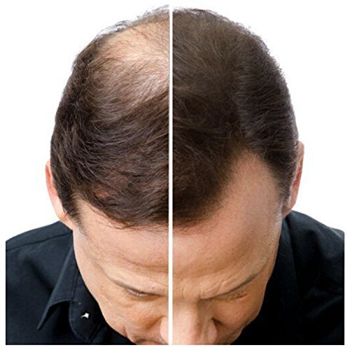 IMPERIO Hair Building Fibers for Thinning Hair - 26g Premium Hair Fibers for Women & Men in Hairdresser Quality - Hair thickening in less than 20 seconds (Medium Brown)