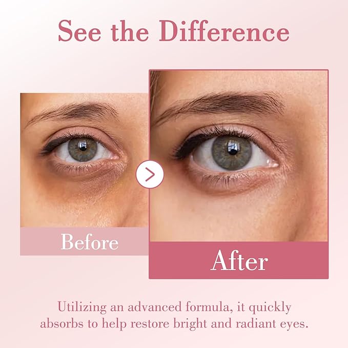 Onespring Eye Cream, Under Eye Cream with Caffeine + Hyaluronic Acid + Vitamin E, for Puffiness, Wrinkles & Fine Lines, Daily Cream for Moisturizing and Hydrating, Skin Care for Face, 1.05 Fl Oz