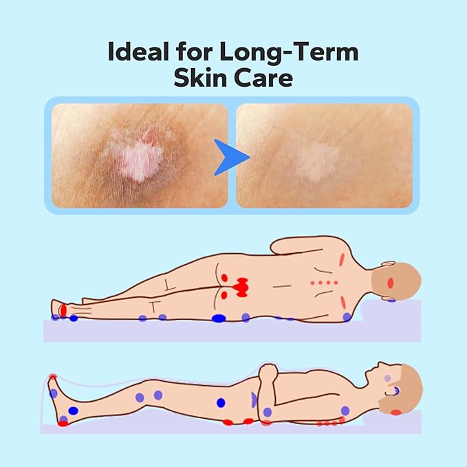 Bed Sore Cream (2.12 Oz), Bedsore Cream Fast Healing, Treatment for Bed Sores On Buttocks, Healing Ointment for Bedsore Treatment, Pressure Sore, Wound Care, Chafed Skin and Skin Sores