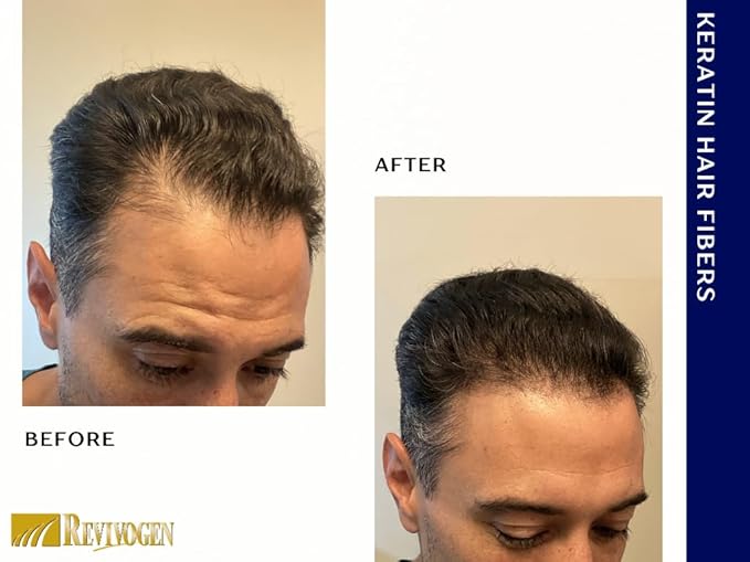 Revivogen MD Keratin Hair Building Fibers, Hairline Powder, Hair Fibers, Hair Fibers for Thinning Hair, Hair Fiber Spray, Thick Fiber for Hair Men and Women, Hair Filler, .9oz, Light Brown