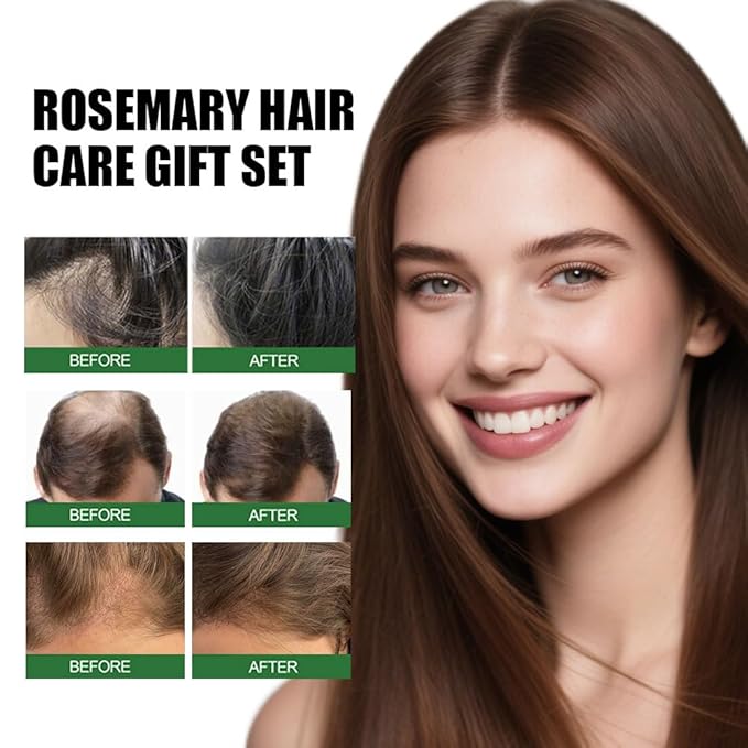 Rosemary Hair Care Gift Set with Essential Oil,Spray and Roller,Rosemary Hair Oil Kit for Strengthening,Nourishing,Scalp Care,Restoration Damaged Hair and Hair Thickness,Gift Box Packaging