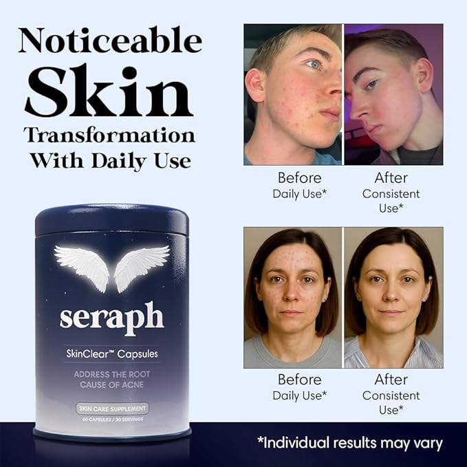 Seraph Acne Supplement - Hormonal Acne Pills Treatment - Pimple Supplements for Women - Skin Clear Capsules for Teen, Men, & Adults - Made in USA - 60 Tablets