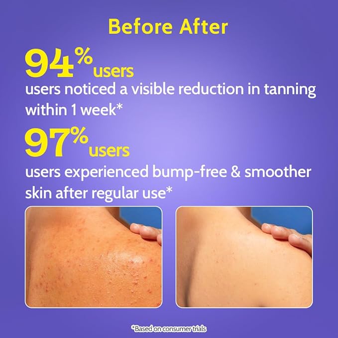 Chemist At Play Body Wash Exfoliating For Dry Rough Bumpy Strawberry Skin With 1% Salicylic Acid 2% Lactic Acid And Ceramides For Men And Women 15.9 Fl oz