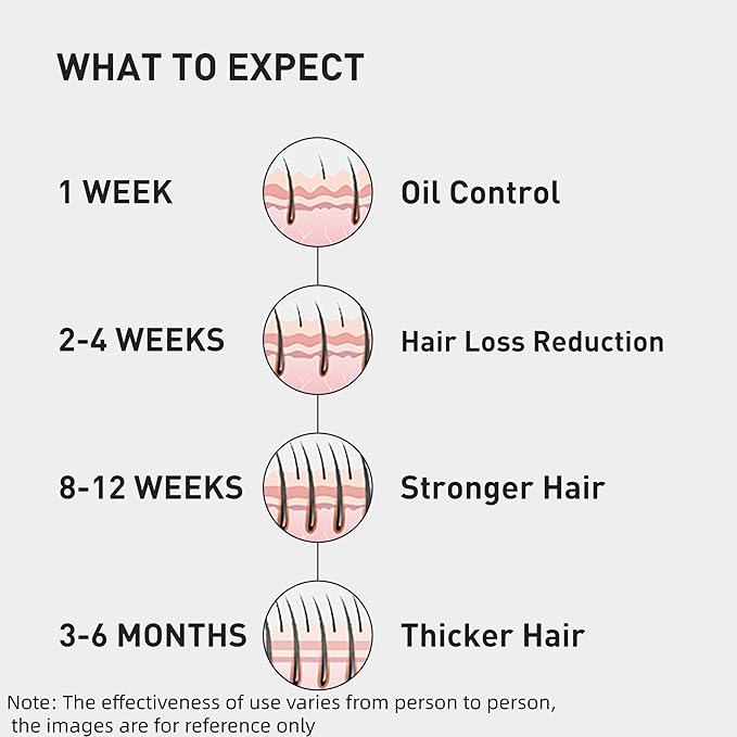 0.5% KINTOR KX-826 Hair Growth Spray,Oil Control Strengthen Hair,Hair Regrowth Products for Women&Men,Basic,60ml