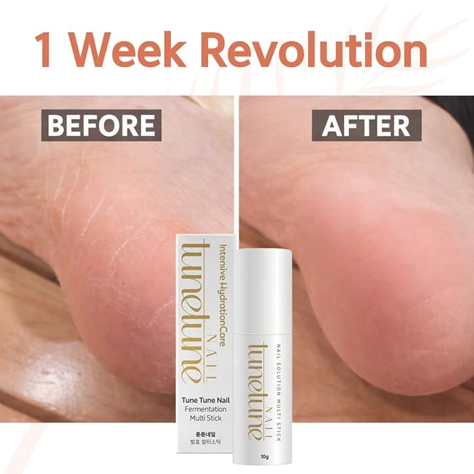 Fermentation Multi Stick | Herbal Fermented Nail Balm | Deep Nourishment & Hydration | Vegan Certified Natural Nail Care | For Dry or Rough Nails | Compact & Travel-Friendly | 10g