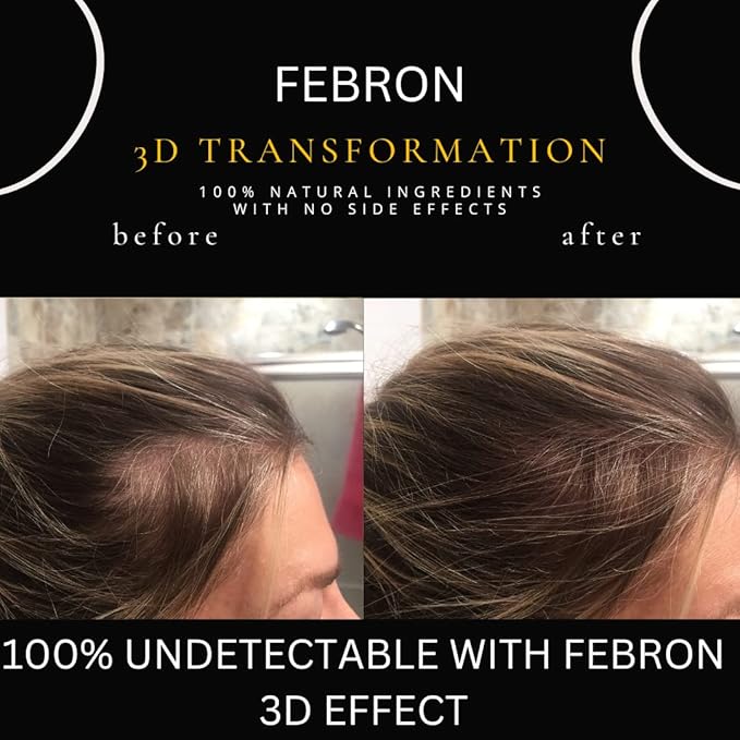 FEBRON Hair Fibers For Thinning Hair MEDIUM BROWN Giant 30G For Women & Men Hair Loss Concealer Hair Powder Volumizing Based 100% Undetectable & Natural - Bold Spots Filler
