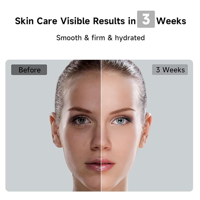 JOVS Laser Hair Removal, 37°F Painless Hair Removal Device with Sapphire Ice-Cooling, 3 in 1 Hair Removal & Skin Rejuvenation for Women and Men, 8 Modes Skin Care for Whole Body, Touch Screen, White