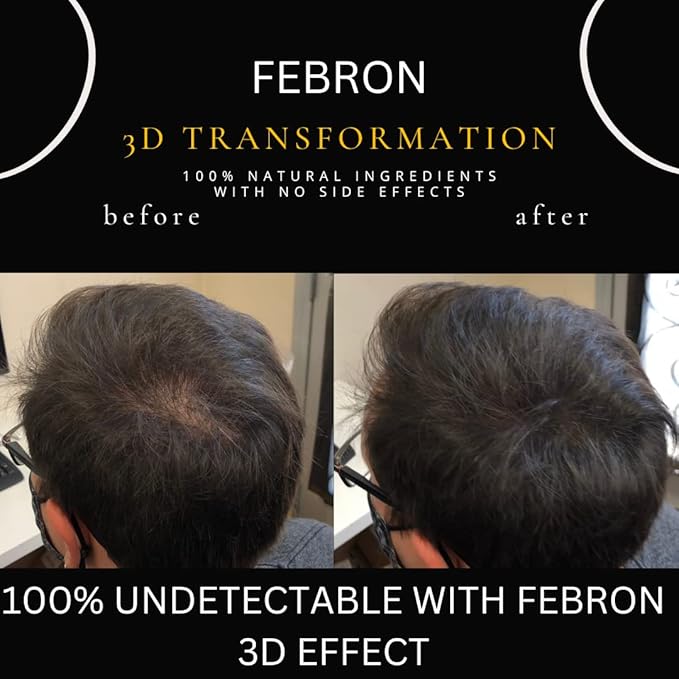 FEBRON Hair Fibers For Thinning Hair MEDIUM BROWN Giant 30G For Women & Men Hair Loss Concealer Hair Powder Volumizing Based 100% Undetectable & Natural - Bold Spots Filler