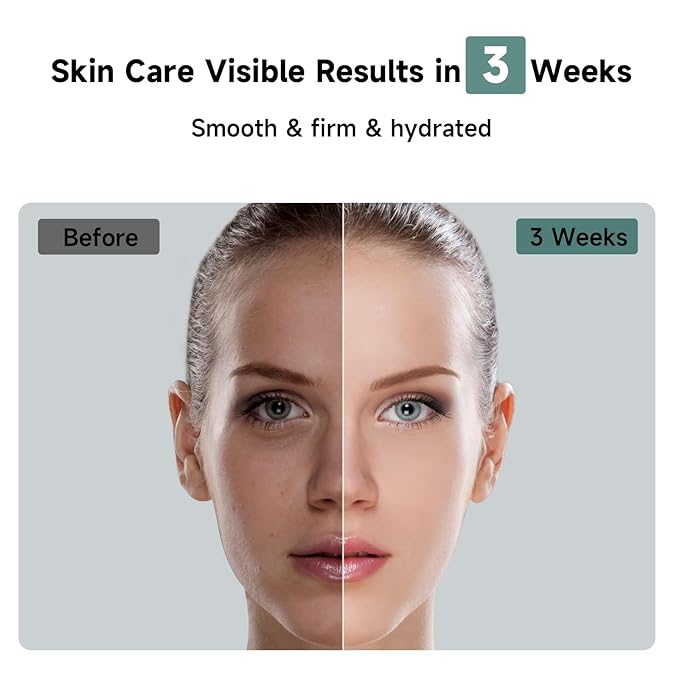 JOVS Laser Hair Removal, 37°F Painless Hair Removal Device with Sapphire Ice-Cooling, 3 in 1 Hair Removal & Skin Rejuvenation for Women and Men, 8 Modes Skin Care for Whole Body, Touch Screen