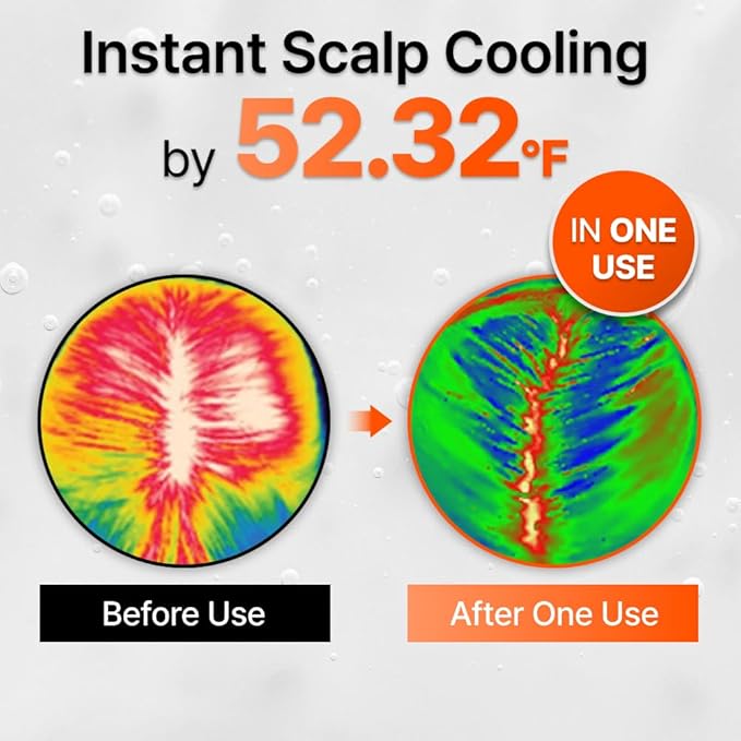 lilyeve GROWTURN Hair Growth Serum with Built-in Brush, Heartleaf-Derived Exosomes to Revitalize Hair, Hair Thickening, Hair Growth Accelerator - Korean Hair Care, 3.38 fl. oz. (Pack of 1)