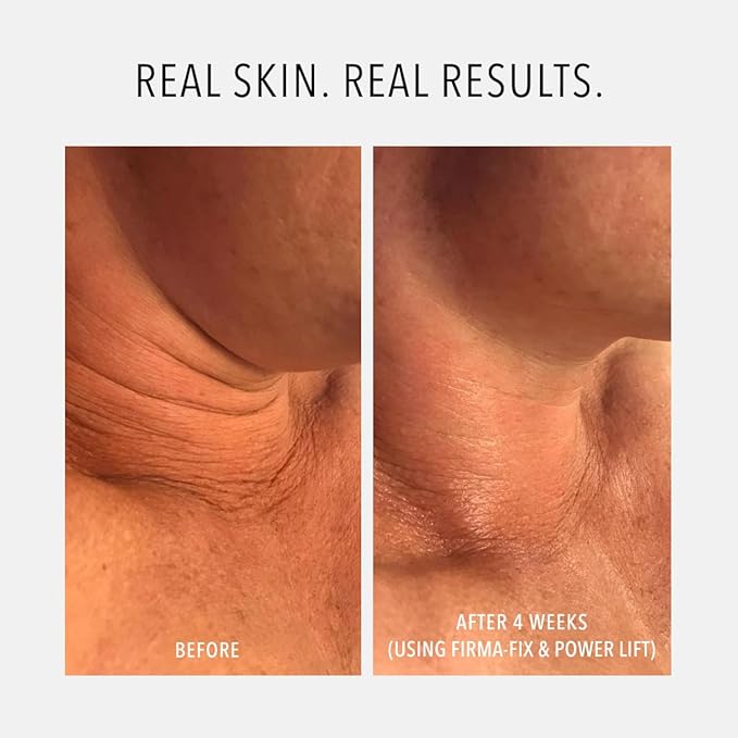 HydroPeptide Firm-A-Fix Nectar Lifting Neck & Décolleté Peptide Serum, 1.7 Ounce