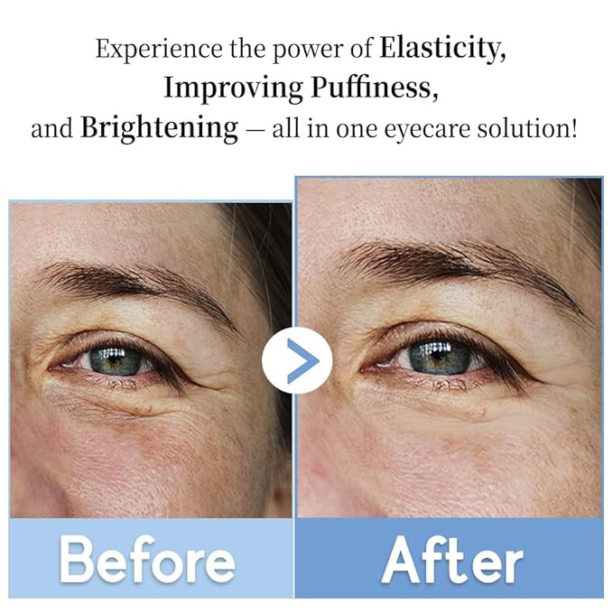 Purederm Revitalizing Eye Gel Serum – Cooling Eye Roller with 5% Volufiline, Caffeine & Vegan Collagen – Reduce Puffiness, Fine Lines & Dark Circles – For All Skin Types – 0.88 oz