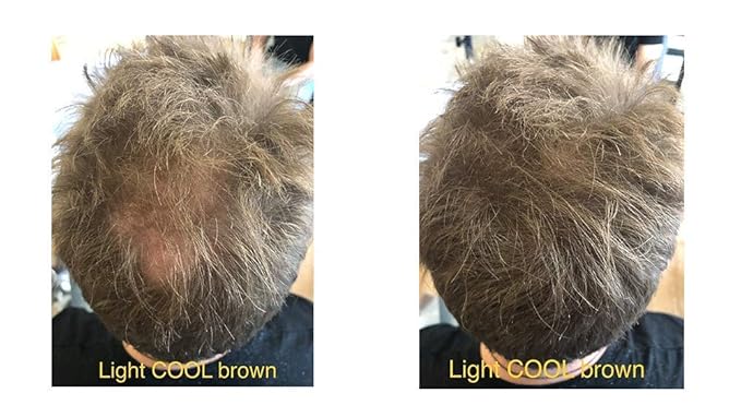 FEBRON Hair Fibers For Thinning Hair For Women & Men Hair Loss Concealer Hair Powder Volumizing Based 100% Undetectable & Natural - Bald Spots Filler (30 Gram, Light COOL Brown)