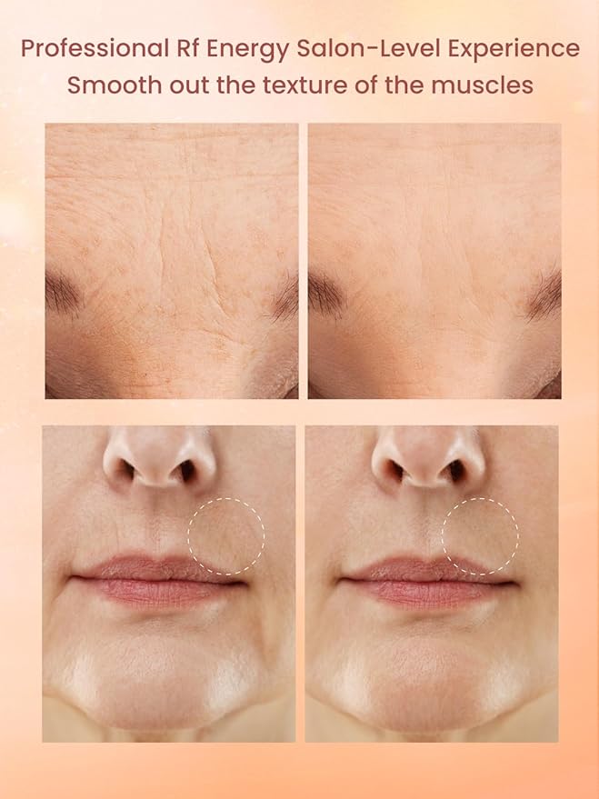 RF Radio Frequency Facial Device, 1MHz RF Machine for Anti-Aging & Face Lifting, Wireless Skin Tightening for Wrinkles & Jawline, 3 Modes for Home Use with Gel