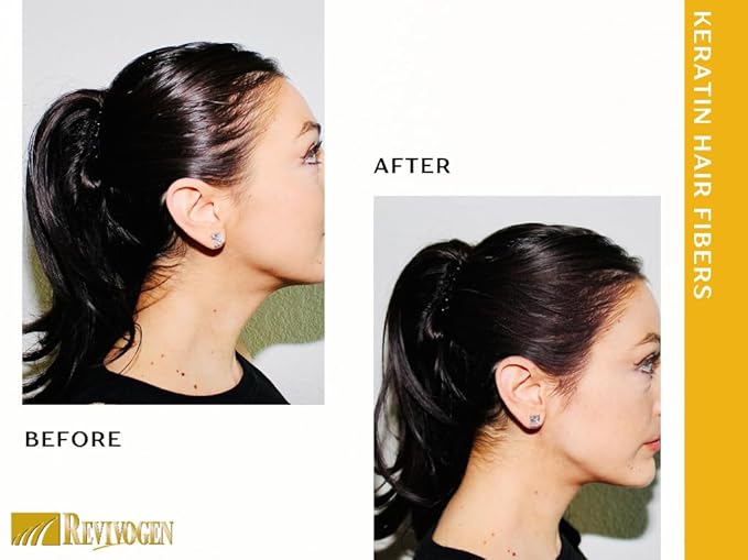 Revivogen MD Keratin Hair Building Fibers, Hairline Powder, Hair Fibers, Hair Fibers for Thinning Hair, Hair Fiber Spray, Thick Fiber for Hair Men and Women, Hair Filler, .9oz, Light Brown