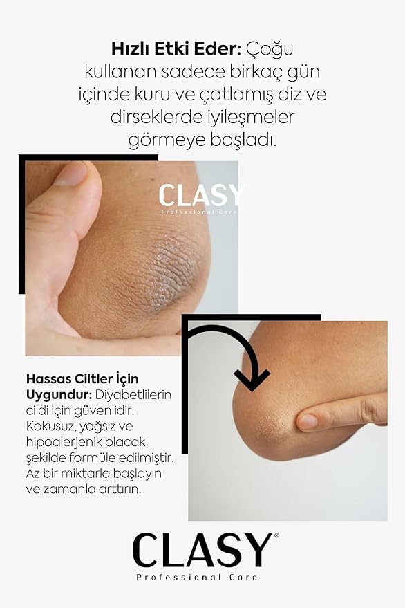 Hand, Knee & Elbow Care Cream - Against Cracked, Dried, Dark Hard Skin