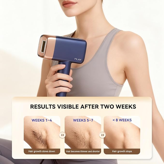 MLAY T14 IPL Epilator – 96.39% Hair Reduction in 4 Weeks, 500 Million Flashes, Pain-Free with Cooling System (Not a Laser), Suitable for All Skin Types, Blue