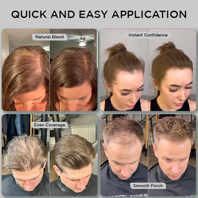 THICK FIBER Hair Fibers for Thinning Hair & Bald spots (MEDIUM BROWN) - 25g Bottle - Conceals Hair Loss in Seconds - Hair Powder for Women & Men