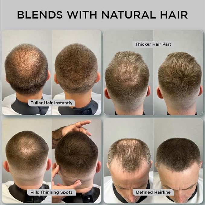 THICK FIBER Hair Fibers for Thinning Hair & Bald spots (MEDIUM BROWN) - 25g Bottle - Conceals Hair Loss in Seconds - Hair Powder for Women & Men