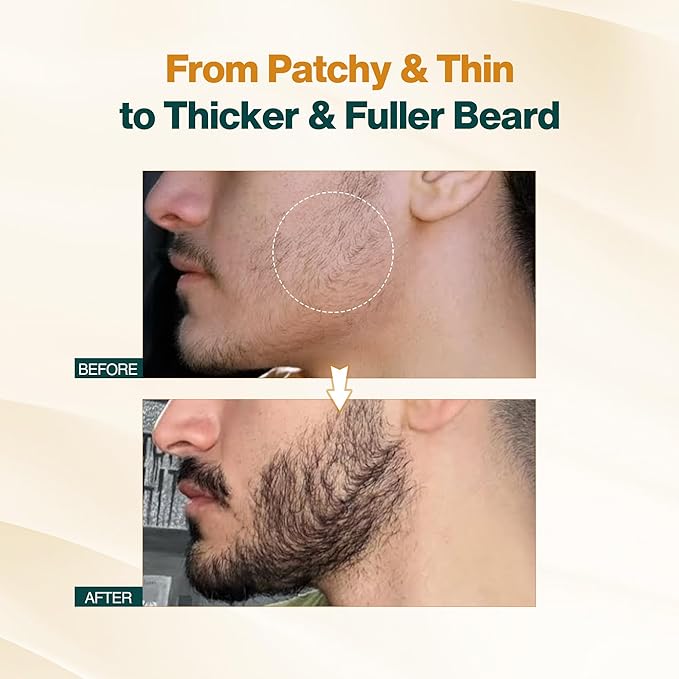 NOURISH MANTRA - Advanced Beard Growth Oil Serum | Made with Redensyl, Capilia Longa, Argan Oil, Vitamin E and Jojoba Oil for Fuller, Thicker & Healthier Beard Growth | Beard Oil Serum For Men | 30 ml