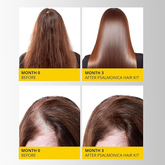 Hair Growth Shampoo and Conditioner Set: Mens Sulfate Free Hair Growth Root Activator Thickening Shampoo for Hair Loss and Thinning Hair - Hair Loss RegrowthTreatments for Women Men