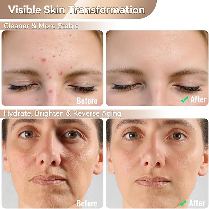 WAYCOM Red Light Therapy Mask: FDA-Cleared 400 LEDs Portable LED Light Therapy for Face - 4-Modes Portable Blue Orange 850NM Infrared & Red Light Mask at Home Travel with Timing Function Remote Black