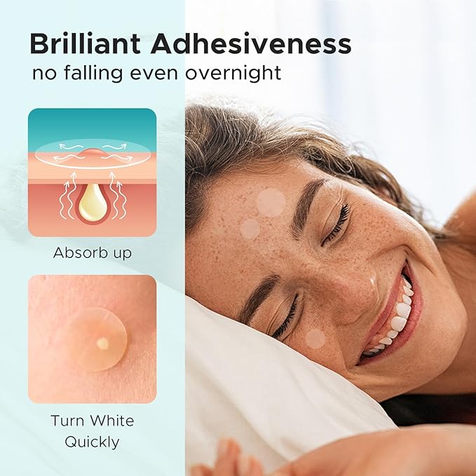 TKTK Pimple Patch Acne Patch, 4 Sizes 140 Patches Acne Absorbing Cover Patch, Hydrocolloid Invisible Acne Patches for Face Zit Patch Acne Dots Tea Tree, Calendula Oil