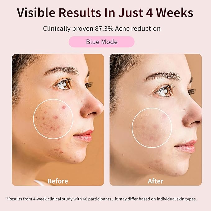 FDA-Cleared Red Light Therapy Mask for Face – 3 Modes for Acne and Wrinkles, 5 Intensity Levels，850nm Infrared Led Light Therapy Device, Pink