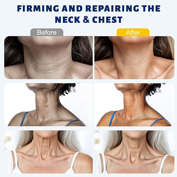 Z:SEA Neck Firming Cream with Roller, Anti-Aging Neck & Chest Cream with Multi Peptide + Collagen + Hyaluronic Acid + Ceramide, Pro-Xylane, Panthenol, Smooths Wrinkles & Fine Lines