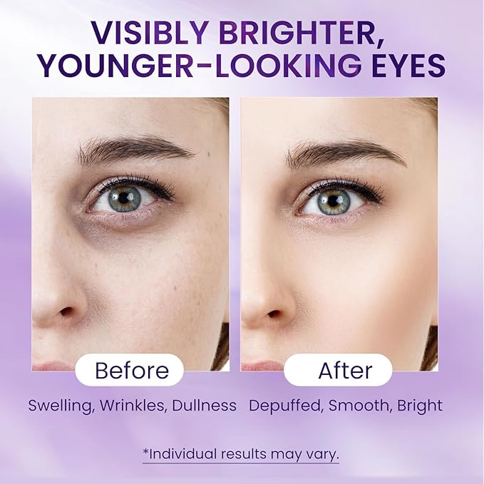 Doracome Caffeine & Retinol Under Eye Serum – Dermatologist-Tested, Fast Absorbing, Correction for Puffy Eye Bags Fine Lines Dark Circles Wrinkles While Providing Moisturizing Care