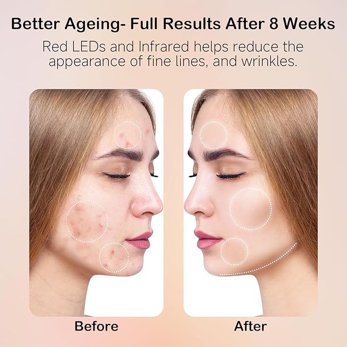 Face Mask Light Therapy, LED Red Light Therapy for Face, Infrared & Red Light Therapy for Face, 6000mAh Rechargeable Portable Redlight Facial Device for Home Use