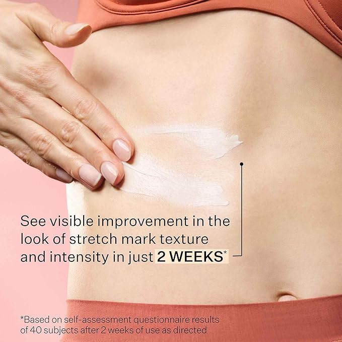 StriVectin SD Advanced Plus Intensive Moisturizer for Wrinkles and Stretchmarks, For Face and Body, Collagen Boosting with Peptides and Hyaluronic Acid, 4 Fl Oz (Pack of 1)