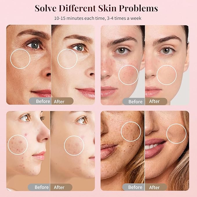 FDA-Cleared Red Light Therapy Mask for Face – 3 Modes for Acne and Wrinkles, 5 Intensity Levels，850nm Infrared Led Light Therapy Device, Pink