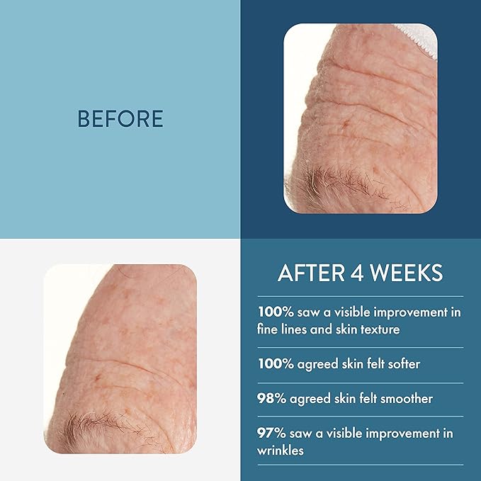 Lancer Skin Care - The Method: Sensitive-Dehydrated Set