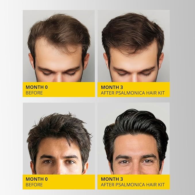 Hair Growth Shampoo and Conditioner Set: Mens Sulfate Free Hair Growth Root Activator Thickening Shampoo for Hair Loss and Thinning Hair - Hair Loss RegrowthTreatments for Women Men