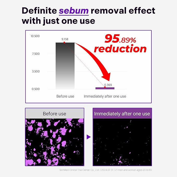 ALIVELAB O2 Scalp Water Shampoo for Sensitive Scalp, Itchy, Anti Dandruff, Deep Cleansing and Soothing, Hair Care, Scalp cleanser, Water Type, Liquid shampoo, Silicone-Free 22 fl oz