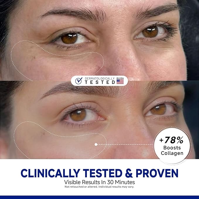 Peptide Under Eye Patches, Firming Eye Patches Instant Reduces Dark Circles and Puffiness, Collagen Under Eye Mask for Bags Treatment, Wrinkles, 12 Pairs, Vegan