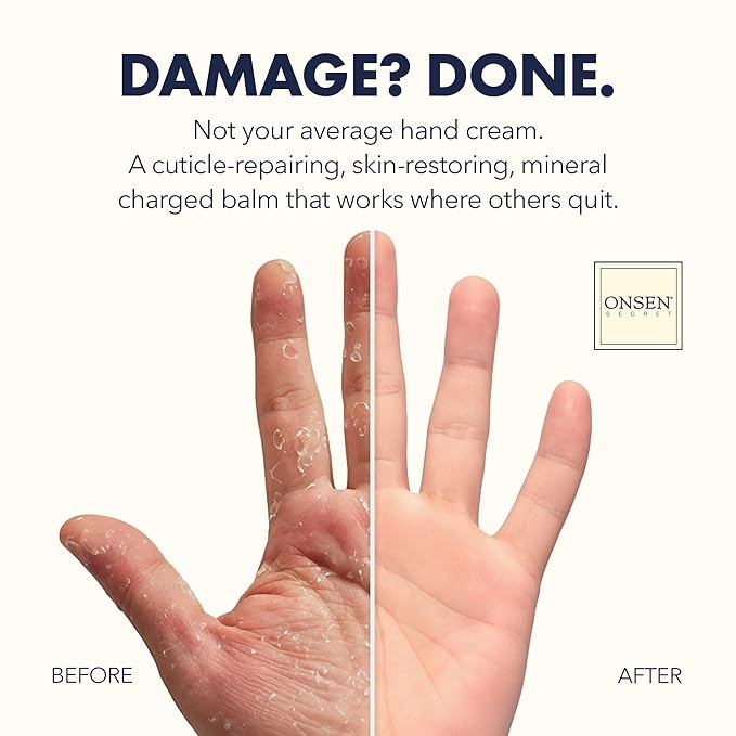 Onsen Secret Advance Rescue Nail Kit - Strengthening Nail Oil & Serum with Hand & Cuticle Rescue Cream - Tsubaki, Shea Butter, Jojoba - Hydrates, Repairs, and Restores