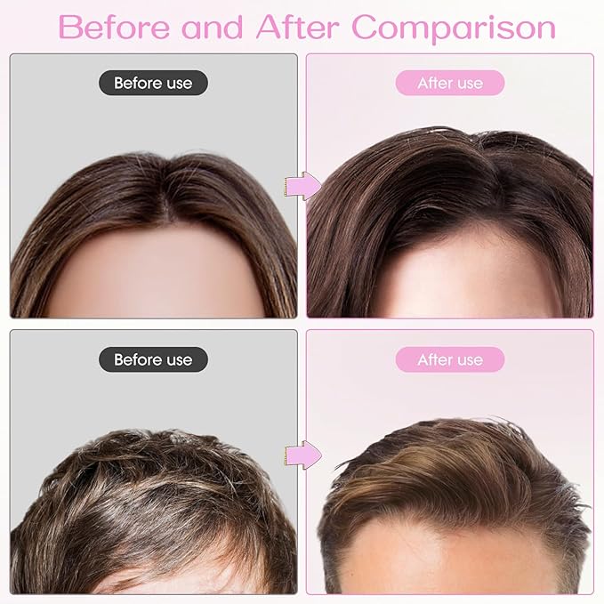 Volumizing Hair Clips for Women 2PCS, Hair Volume Clip Styling Tools Volumizing Comb for Fluffy Bangs Clips for Root Lift, Root Booster Clips